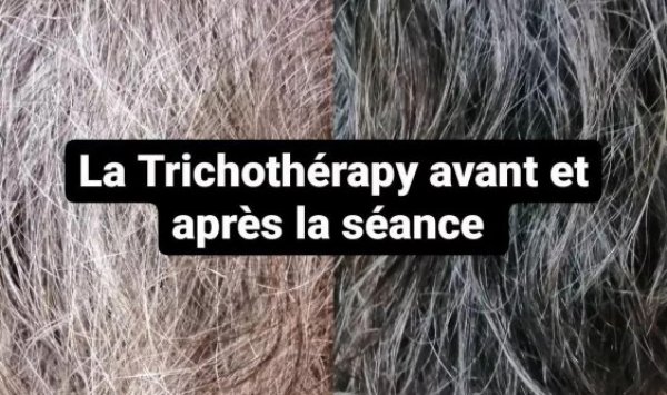 Chimiothérapie, la Trichothérapy est efficace avant et après 